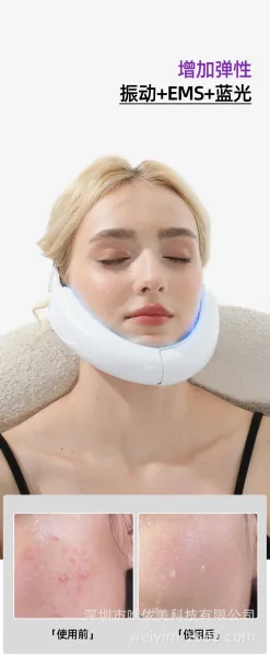 Design WeiYim V-Face Shaping Thermal Massage Device White Electronics - 7