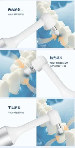 Design Dental Polishing Tool Silver Professional Oral Care Device Electronics - 8