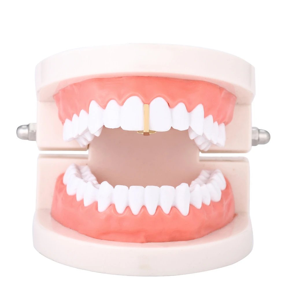 Gold Tooth Cap