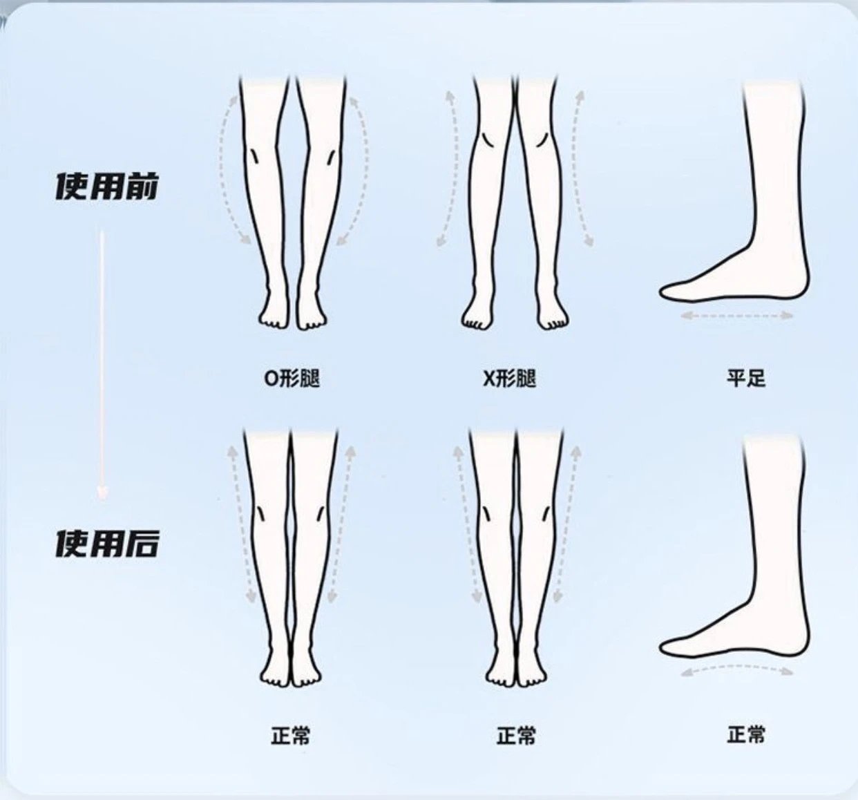 Design Sports Insoles Blue Green Arch Support Insoles Shoes - 3