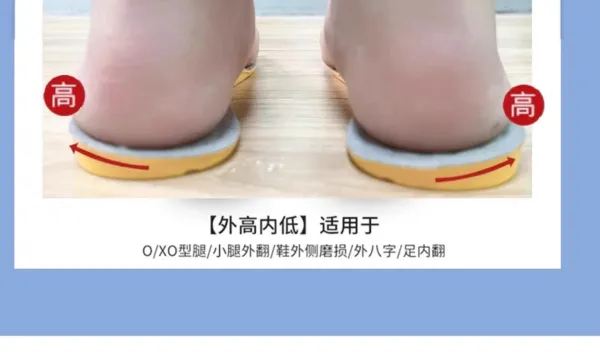 Design Orthotic Insole for O / X Leg and Foot Pronation Correction Gray Yellow Shoes - 8