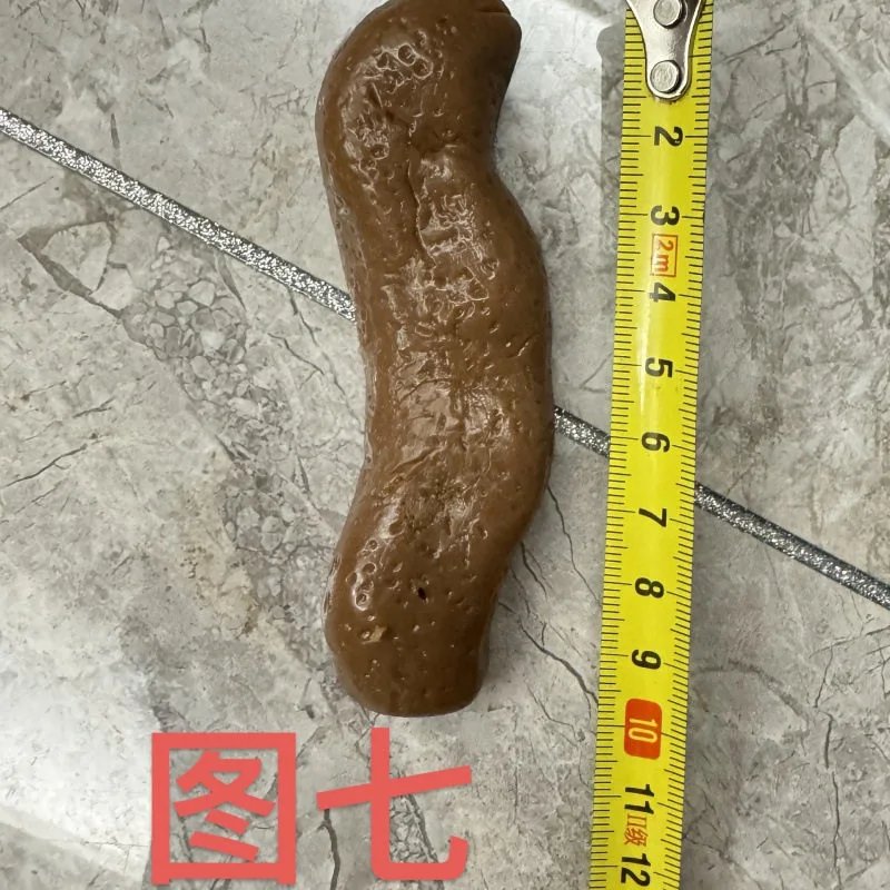 Figure 7 Poo TPR