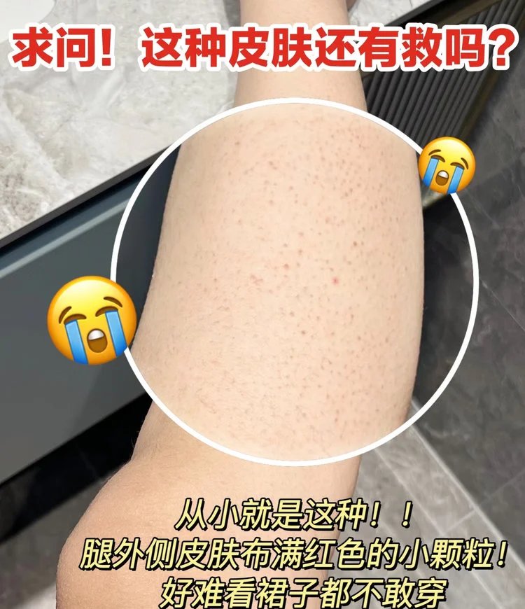 Supermarket out of stock king 💰 thirty-nine point nine 🉐 2 large bottles ❗ Body lotion with Olay added 🔥 The same niacinamide desert dry skin has been nourished and moisturized, making the skin tender and smooth. 【 SHIMVXION_ Velvet Petal Fragrance Body Lotion 】 Softens keratin, soothes dry chicken skin, and relieves back lumps and itching. w030303