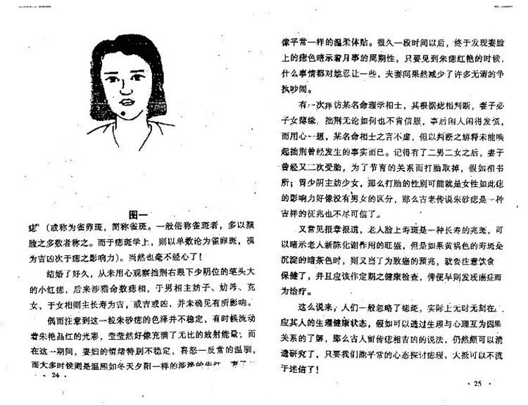 痣相大全插图3 痣相大全插图3