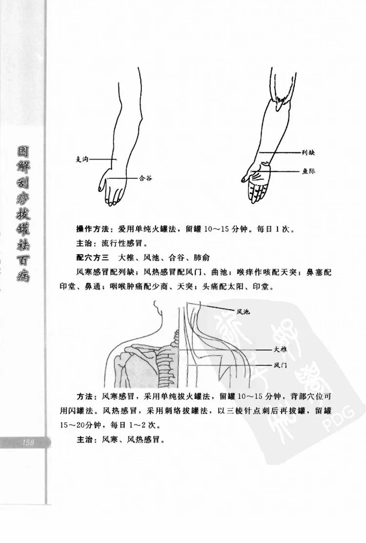 图解刮痧拔罐祛百病插图3 图解刮痧拔罐祛百病插图3