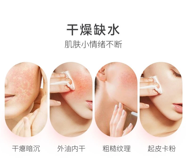[Yimeicang] Wool collection with sisters [Chunyan Anrun moisturizing facial mask (small reservoir facial mask) 5 pieces/box] dry moisturizing skin soothing sensitive season changing skin care products