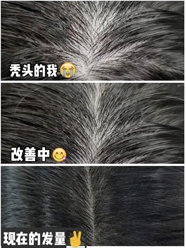 德国技术土耳其制造8倍防脱bioxcin柏科生植物防脱固发洗发水