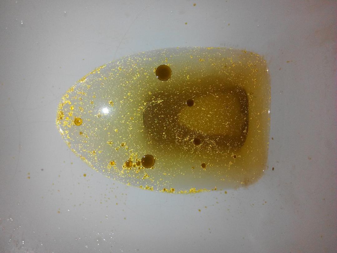 韩国排油丸正品带香港小票店主试用杠杠滴