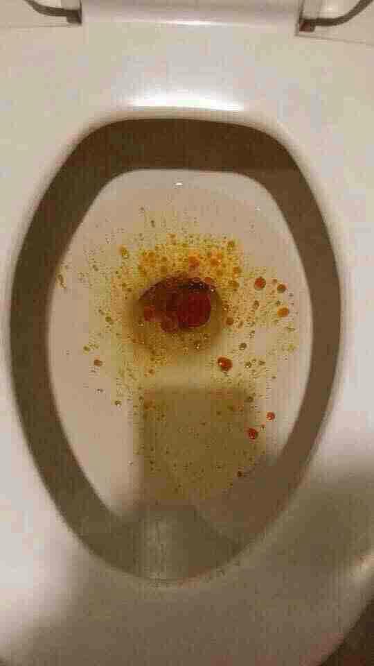 不一样的外表,一样的心,据说是一粒不出油,全额退款呢 排油丸第一盒