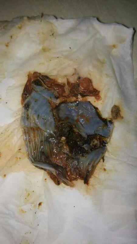 女人那些事儿…… 1 如果你正在奔三,你的子宫会产生,乳白色垃圾; 2