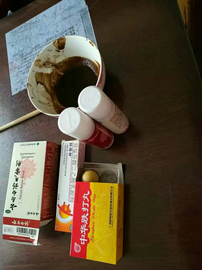 中学生体育课扭伤脚踝不能着地十余天 活络油热敷 跌打丸外敷四天可下地 中学生体育课扭伤脚踝不能着地十余天 活络油热敷 跌打丸外敷四天可下地