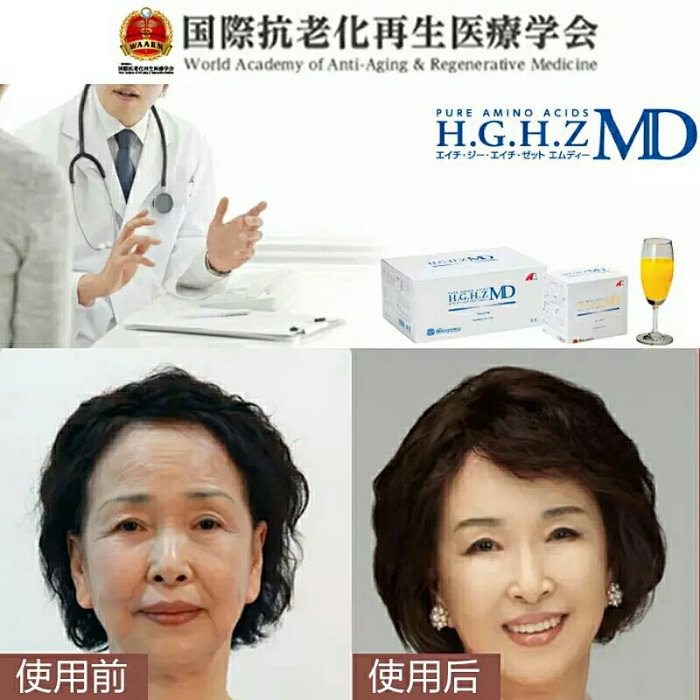 日本hgh生长素冲剂md版h G H Z Md医院版获奖专利