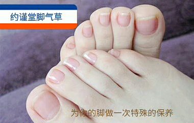 得了脚气怎么办 教你一招 轻松搞定