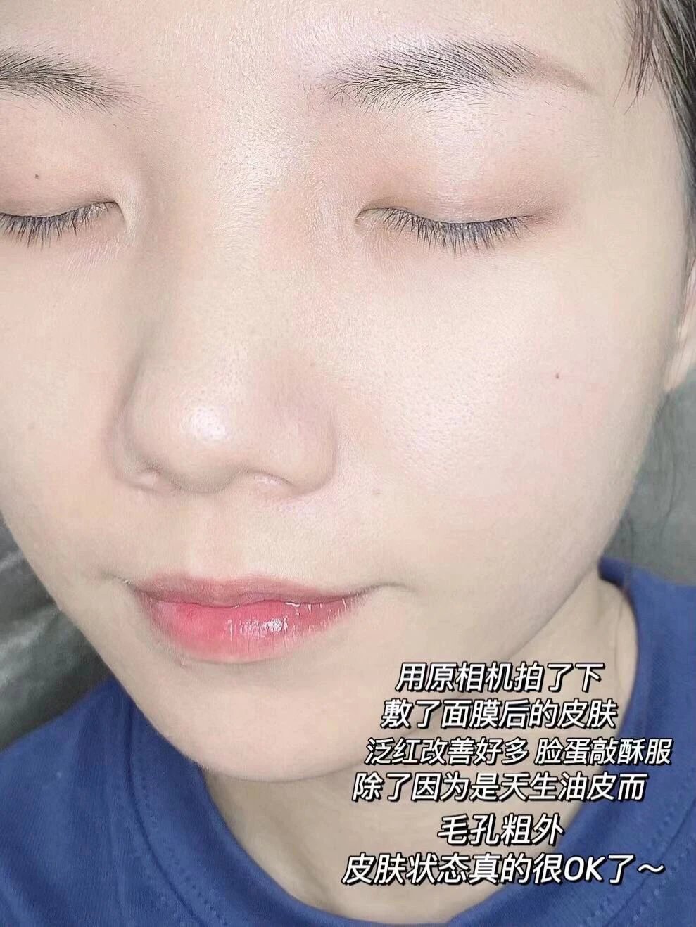 [Medical Beauty Warehouse] ⚠The new internal volume king❗The "Kefumei Ice Cream Mask 2.0" is more pro than 1.0. It has the same ingredients as 𝐋𝐚𝐦𝐞𝐫 and adds centella asiatica 🔺 to moisturize and repair, shrink pores, soothe redness and brighten skin tone.