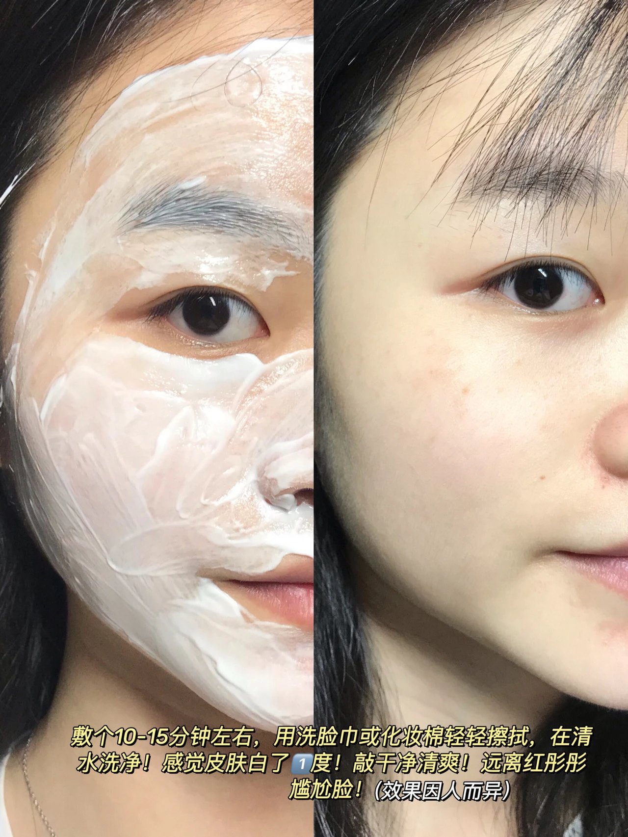 [Medical Beauty Warehouse] ⚠The new internal volume king❗The "Kefumei Ice Cream Mask 2.0" is more pro than 1.0. It has the same ingredients as 𝐋𝐚𝐦𝐞𝐫 and adds centella asiatica 🔺 to moisturize and repair, shrink pores, soothe redness and brighten skin tone.