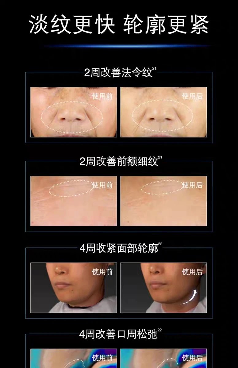 [Tianjin Warehouse] 25-year-old new version of SkinCeuticals AGE Cream 15ml 30% Bose for firming, brightening sensitive skin, anti-sugar and antioxidant, expires after June 27